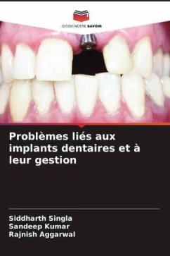 Problèmes liés aux implants dentaires et à leur gestion - Singla, Siddharth;Kumar, Sandeep;AGGARWAL, RAJNISH