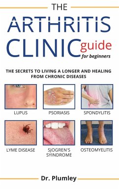 Arthritis Clinic Guide for Beginners: The Secret Book to Discovery Between The Different Type of Rheumatoid Arthritis - Plumley