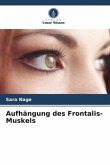 Aufhängung des Frontalis-Muskels