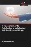 Il riassorbimento fisiologico e patologico dei denti semplificato