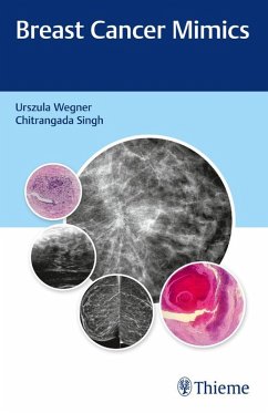 Cover Breast Cancer Mimics (eBook, ePUB)