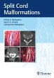 Split Cord Malformations (eBook, ePUB) - Bild 1