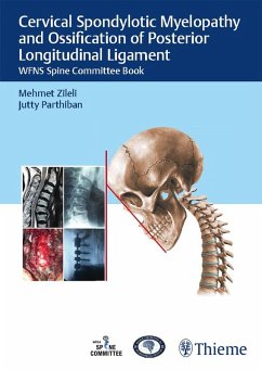 Cover Cervical Spondylotic Myelopathy and Ossification of Posterior Longitudinal Ligament (eBook, ePUB)
