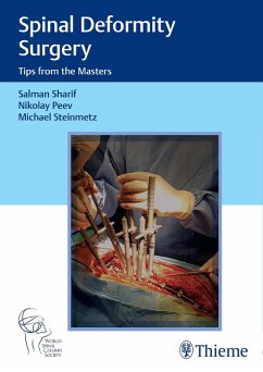Cover Spinal Deformity Surgery (eBook, PDF)