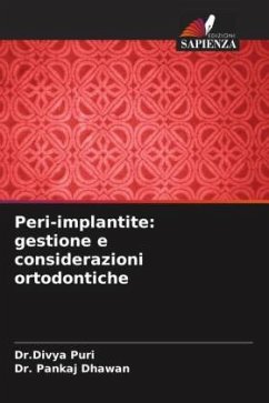 Peri-implantite: gestione e considerazioni ortodontiche - Puri, Divya;Dhawan, Pankaj