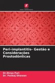 Peri-implantitis- Gestão e Considerações Prostodônticas