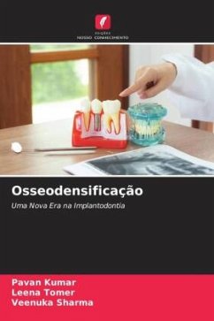 Osseodensificação - Kumar, Pavan;Tomer, Leena;Sharma, Veenuka