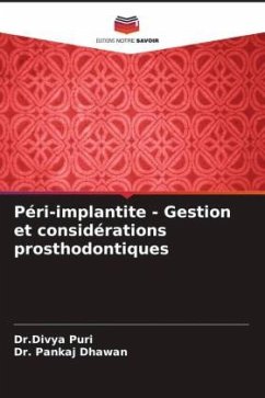 Péri-implantite - Gestion et considérations prosthodontiques - Puri, Divya;Dhawan, Pankaj