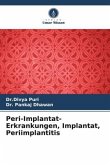 Peri-Implantat-Erkrankungen, Implantat, Periimplantitis