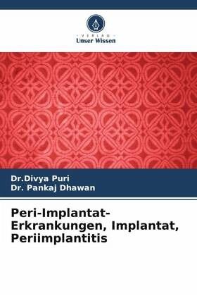 Peri-Implantat-Erkrankungen, Implantat, Periimplantitis Peri-Implantat-Erkrankungen, Implantat, Periimplantitis