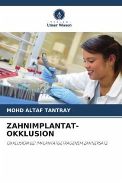 ZAHNIMPLANTAT-OKKLUSION - Tantray, Mohd Altaf