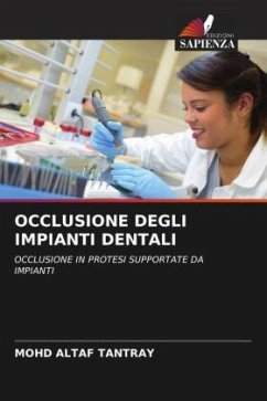 OCCLUSIONE DEGLI IMPIANTI DENTALI - Tantray, Mohd Altaf