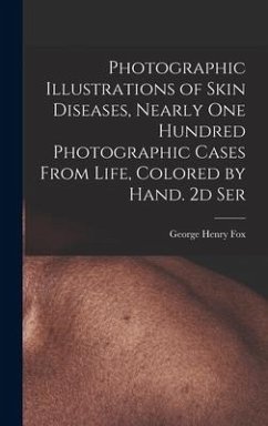 Photographic Illustrations of Skin Diseases, Nearly One Hundred Photographic Cases From Life, Colored by Hand. 2d Ser - Fox, George Henry