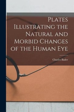 Plates Illustrating the Natural and Morbid Changes of the Human Eye - Bader, Charles