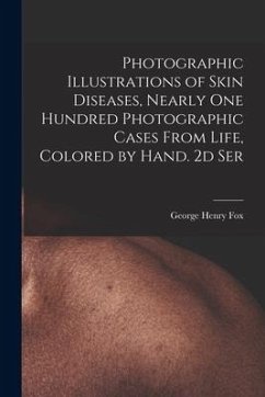 Photographic Illustrations of Skin Diseases, Nearly One Hundred Photographic Cases From Life, Colored by Hand. 2d Ser - Fox, George Henry