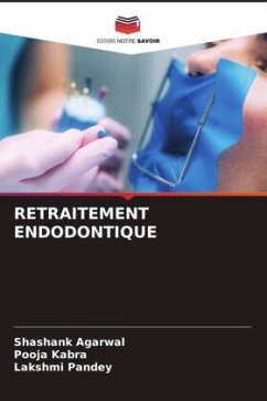 RETRAITEMENT ENDODONTIQUE - Agarwal, Shashank;Kabra, Pooja;Pandey, Lakshmi