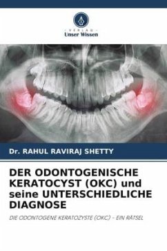 DER ODONTOGENISCHE KERATOCYST (OKC) und seine UNTERSCHIEDLICHE DIAGNOSE - SHETTY, Dr. RAHUL RAVIRAJ