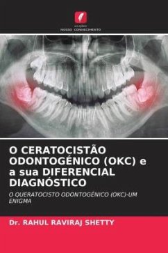 O CERATOCISTÃO ODONTOGÉNICO (OKC) e a sua DIFERENCIAL DIAGNÓSTICO - SHETTY, Dr. RAHUL RAVIRAJ