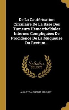 De La Cautérisation Circulaire De La Base Des Tumeurs Hémorrhoïdales Internes Compliquées De Procidence De La Muqueuse Du Rectum...