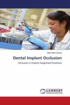 Dental Implant Occlusion