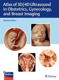 Atlas of 3D/4D Ultrasound in Obstetrics, Gynecology, and Breast Imaging - Merz, Eberhard