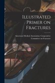 Illustrated Primer on Fractures