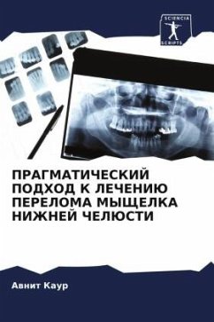 Cover PRAGMATIChESKIJ PODHOD K LEChENIJu PERELOMA MYShhELKA NIZhNEJ ChELJuSTI