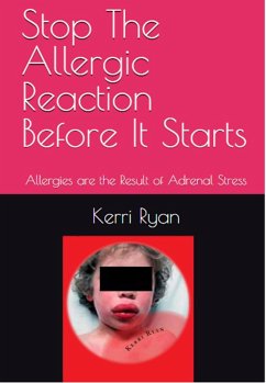 Stop the Allergic Reaction Before It Starts (eBook, ePUB) - Ryan, Kerri