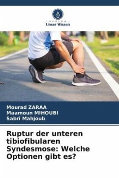 Ruptur der unteren tibiofibularen Syndesmose: Welche Optionen gibt es? - Zaraa, Mourad;Mihoubi, Maamoun;Mahjoub, Sabri