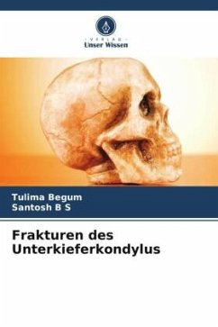 Frakturen des Unterkieferkondylus - Begum, Tulima;B S, Santosh