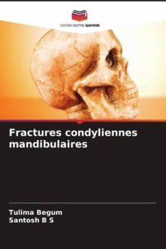 Fractures condyliennes mandibulaires - Begum, Tulima;B S, Santosh