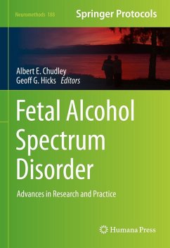 Cover Fetal Alcohol Spectrum Disorder (eBook, PDF)