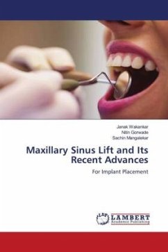 Maxillary Sinus Lift and Its Recent Advances - Wakankar, Janak;Gorwade, Nitin;Mangalekar, Sachin