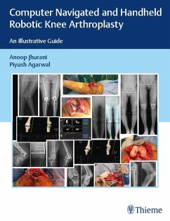 Computer Navigated and Handheld Robotic Knee Arthroplasty (eBook, ePUB) - Jhurani, Anoop; Agarwal, Piyush