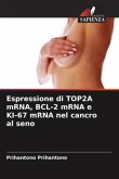 Espressione di TOP2A mRNA, BCL-2 mRNA e KI-67 mRNA nel cancro al seno