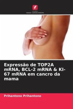 Expressão de TOP2A mRNA, BCL-2 mRNA & KI-67 mRNA em cancro da mama - Prihantono, Prihantono