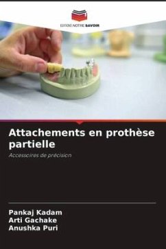 Attachements en prothèse partielle - Kadam, Pankaj;GACHAKE, ARTI;PURI, ANUSHKA