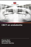 CBCT en endodontie