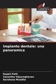 Impianto dentale: una panoramica