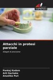 Attacchi in protesi parziale