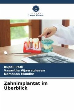 Zahnimplantat im Überblick - Patil, Rupali;Vijayraghavan, Vasantha;Mundhe, Darshana