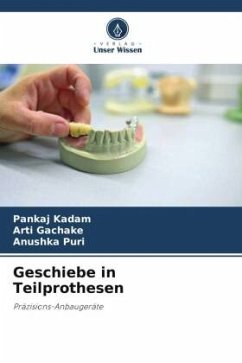 Geschiebe in Teilprothesen - Kadam, Pankaj;GACHAKE, ARTI;PURI, ANUSHKA