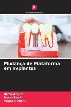 Mudança de Plataforma em Implantes - Anjum, Afroz;Shah, Mona;Doshi, Yogesh