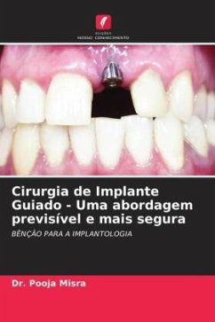 Cirurgia de Implante Guiado - Uma abordagem previsível e mais segura - Misra, Dr. Pooja