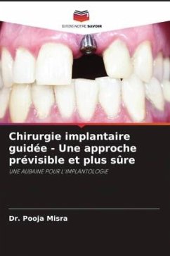 Chirurgie implantaire guidée - Une approche prévisible et plus sûre - Misra, Dr. Pooja