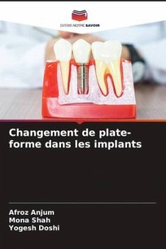Changement de plate-forme dans les implants - Anjum, Afroz;Shah, Mona;Doshi, Yogesh