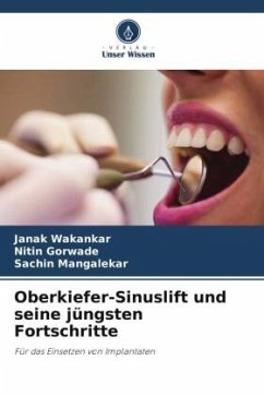 Oberkiefer-Sinuslift und seine jüngsten Fortschritte - Wakankar, Janak;Gorwade, Nitin;Mangalekar, Sachin