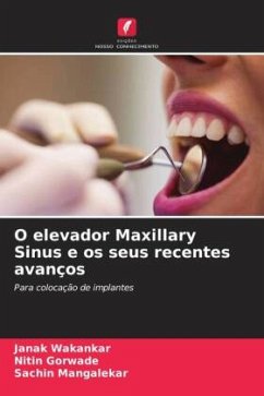 O elevador Maxillary Sinus e os seus recentes avanços - Wakankar, Janak;Gorwade, Nitin;Mangalekar, Sachin