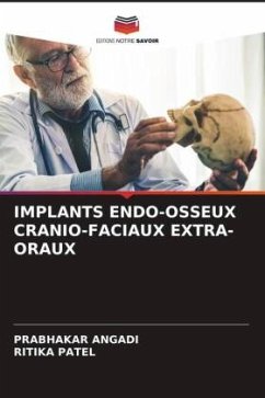 IMPLANTS ENDO-OSSEUX CRANIO-FACIAUX EXTRA-ORAUX - Angadi, Prabhakar;Patel, Ritika