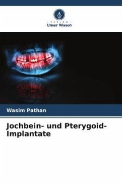 Cover Jochbein- und Pterygoid-Implantate